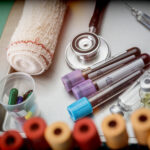 ‘Simon’ 47 Case Study